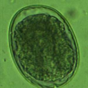 Worm Test Kits