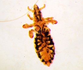 Cattle Lice