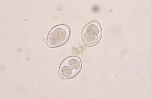 Coccidiosis